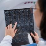 МРТ головного мозга: основные этапы и показания к проведению